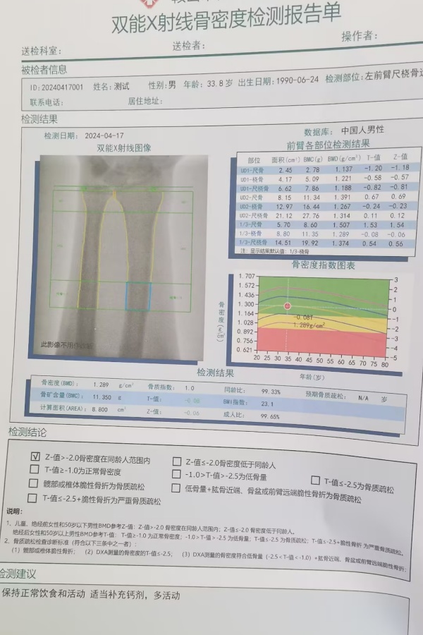 雙能X射線骨密度儀：準確測量骨密度，助力骨質疏松防治，守護骨骼健康